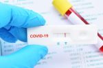 Covid-19 au Maroc : 301 nouvelles infections et 0 décès ce dimanche