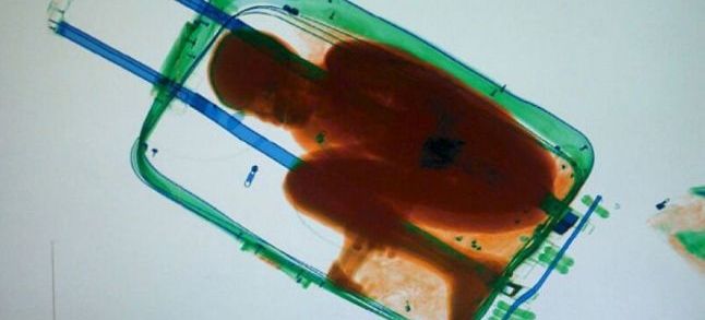 Eight-year-old boy being smuggled to Spain in suitcase caught by police using X-ray scanning on bags crossing border into its Ceuta enclave from Morocco./Ph. DR