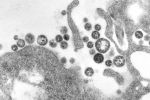 Mortel et proche d'Ebola, le virus Chapare reste une énigme scientifique
