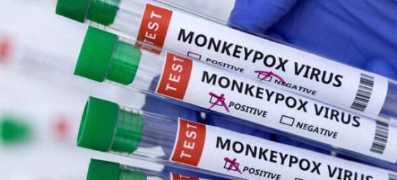 Monkeypox : Morocco faces equal concern, warns doctor