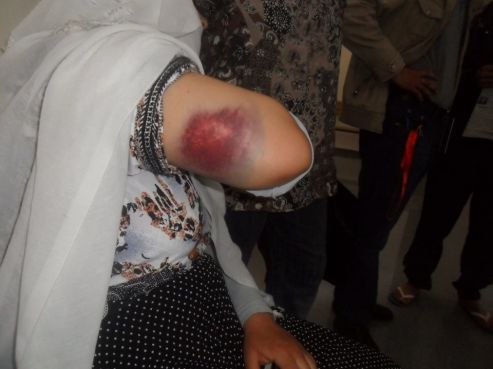 Cri à l'injustice à Tiznit : La police réprime violemment une manifestation ce dimanche