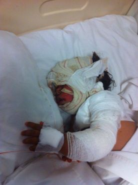 Fatim-Zahra après sa première intervention chirurgicale.