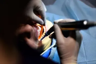 الهيئة الوطنية لأطباء الأسنان تطالب بوقف نشاط محلات عشوائية