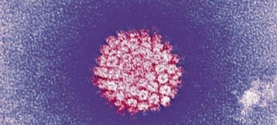 DR