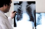 Maroc : Un total de 29 018 cas de tuberculose détecté et mis sous traitement en 2020