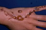 Danger du tatouage au henné noir : Interview du Docteur Benamar