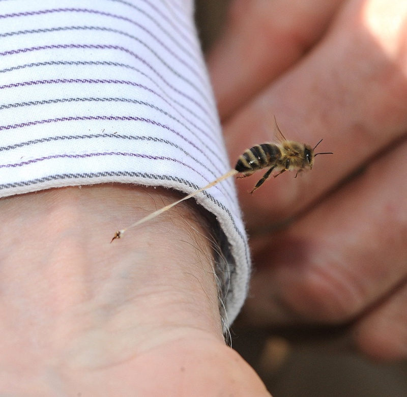 Trucs et astuces Calmer la douleur d’une piqûre d’abeille