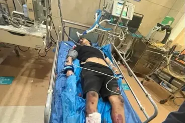 طالب مغربي يدخل في غيبوبة بعد حادثة سير خطيرة بالصين
