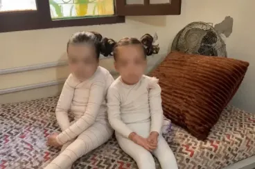 Beni Mellal mother appeals to save daughters with butterfly disease