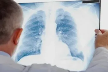 53 في المائة من حالات السل الجديدة المسجلة بالمغرب خلال سنة 2025 تتعلق بالأشكال خارج الرئة